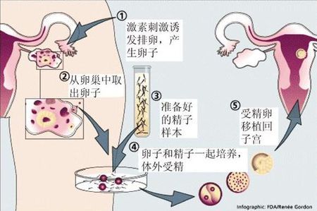 生殖医学科